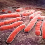 Activaron protocolo sanitario tras un caso de tuberculosis en una escuela de Mar del Plata